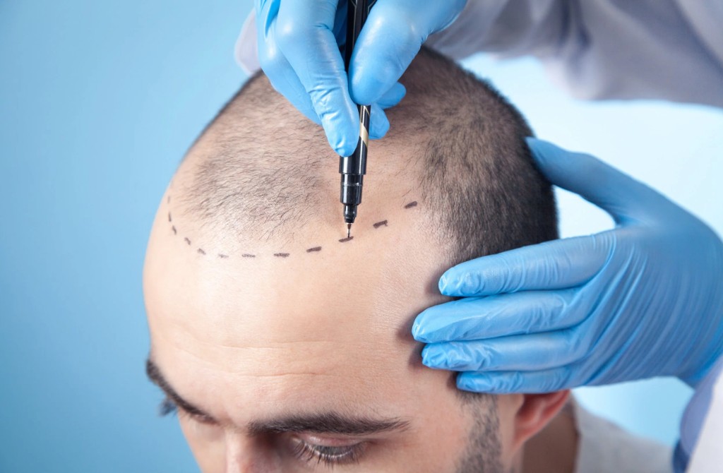 Modern hair restoration clinic environment